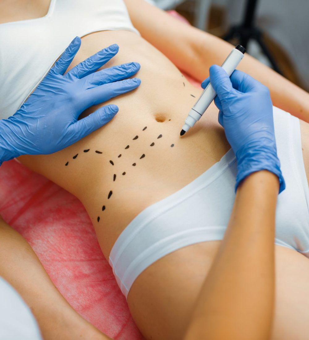 Tratamiento corporal